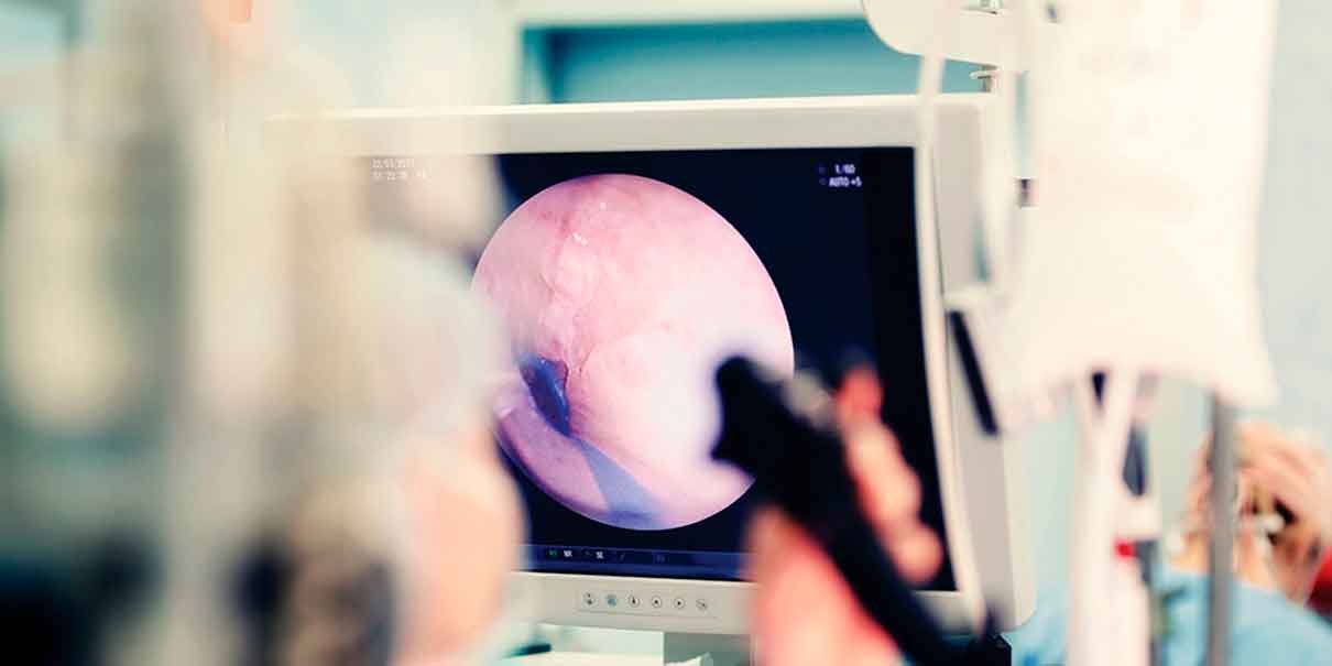 La bacteria vinculada al cáncer gástrico que porta gran parte de México